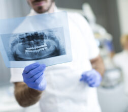 Image of Dentist analyzing an X-ray of teeth